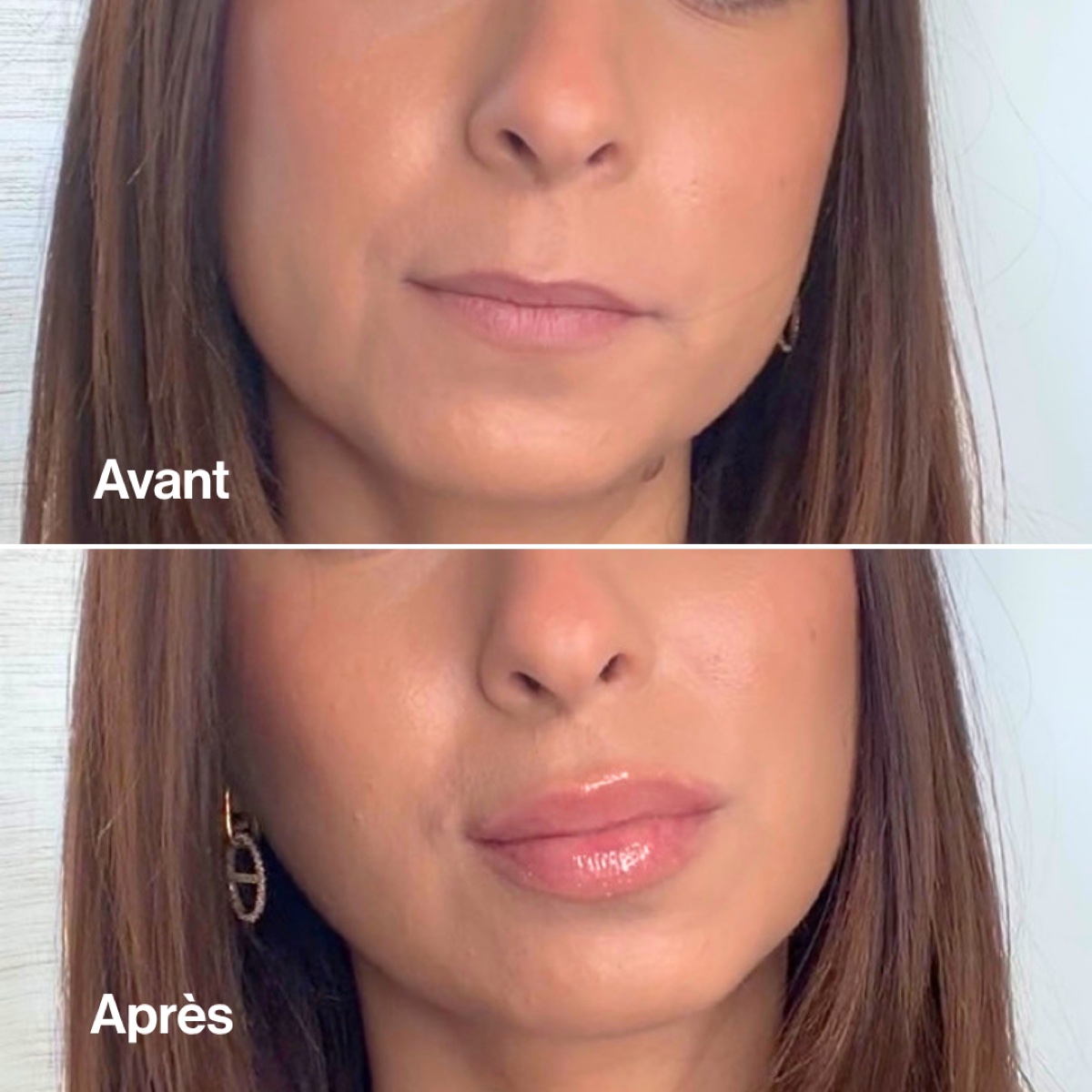 Avant/Après