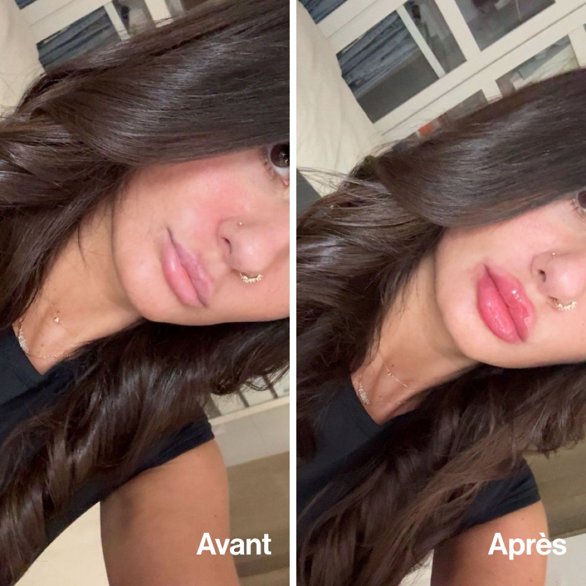 Avant/Après