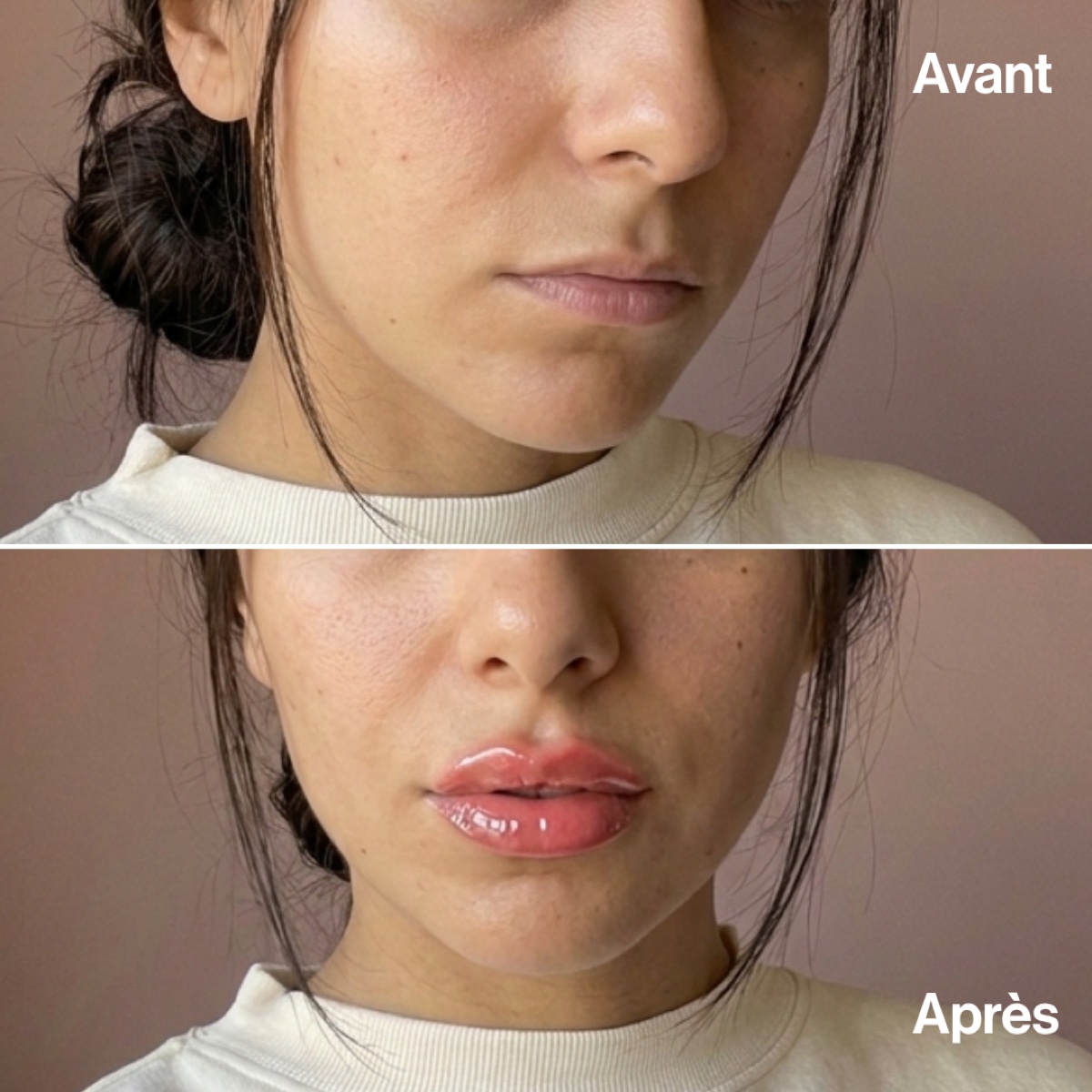 Avant/Après